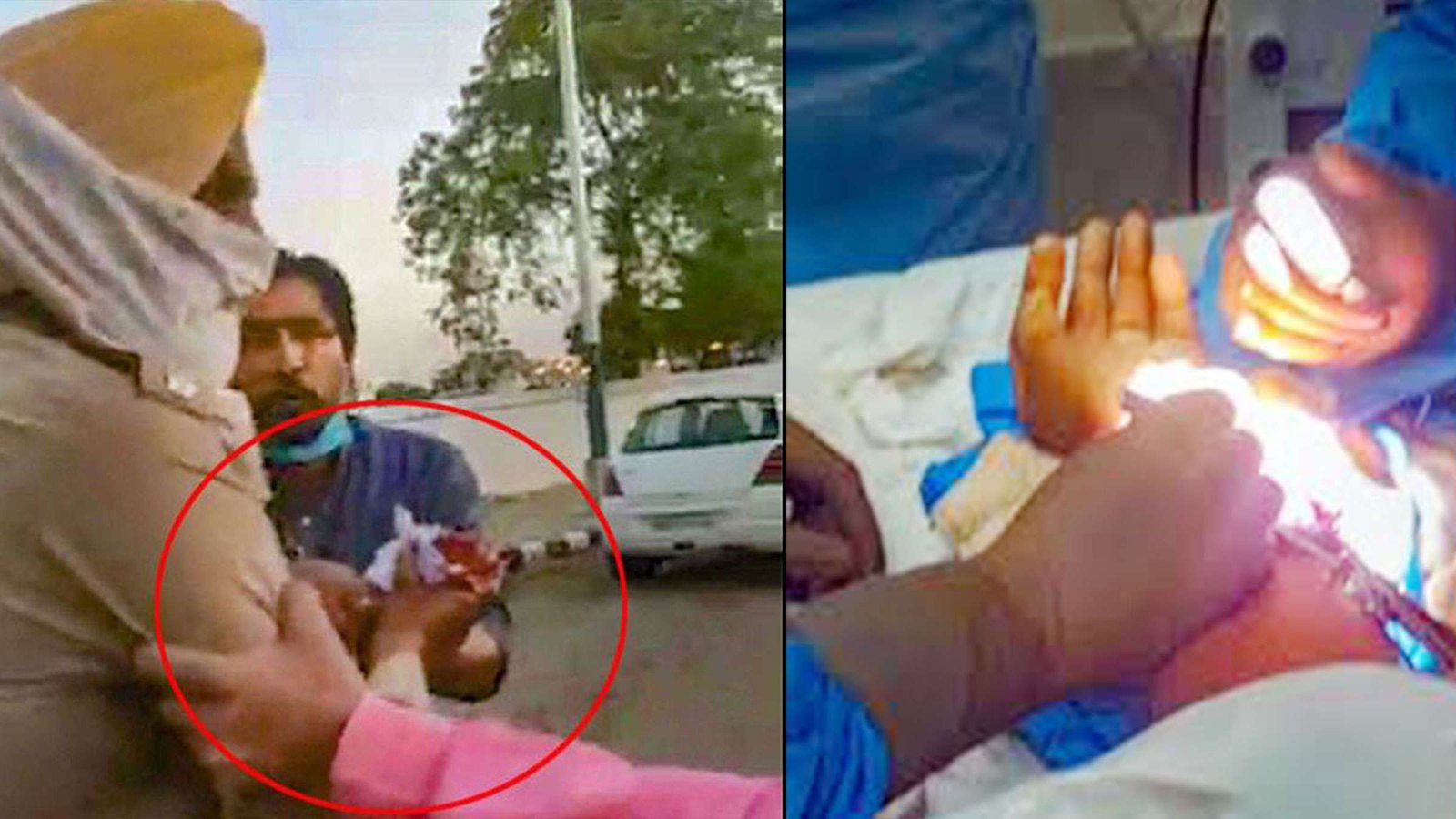 Pakistan using Chinese Virus COVID-19 as Bio-Weapon against India: Activates Proxies: Hand of an Indian Punjab Police officer was cut. He was operated successfully.