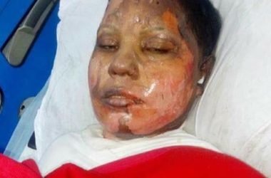 25 Year old Christian girl who refused to convert to Islam and marry a Muslim was attacked by Acid an then set on fire.