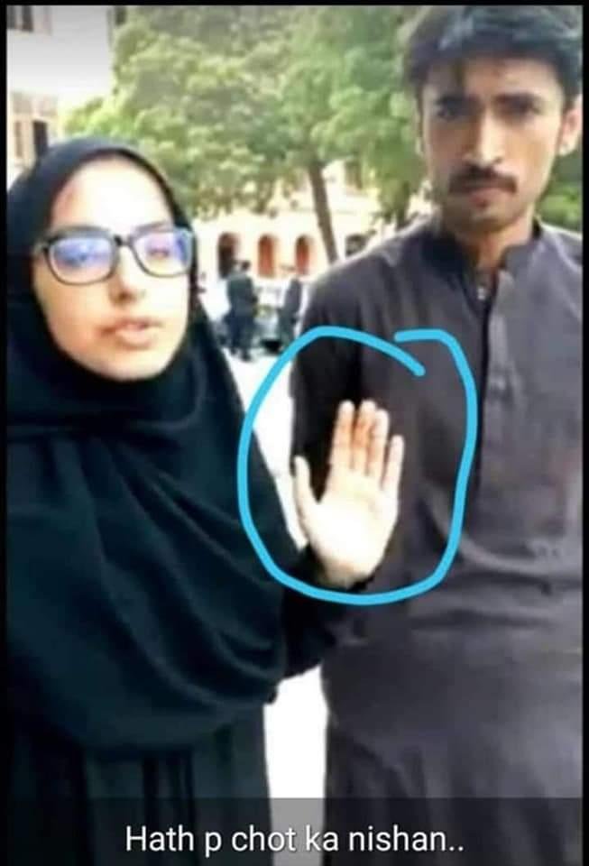 Picture of Payal now converted to Islam with injury marks on her hand