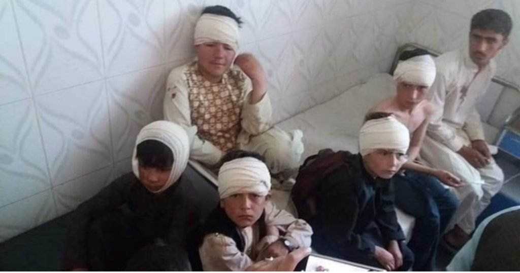 Picture of School children injured in the Ghazni Car Bomb Blast in Hospital