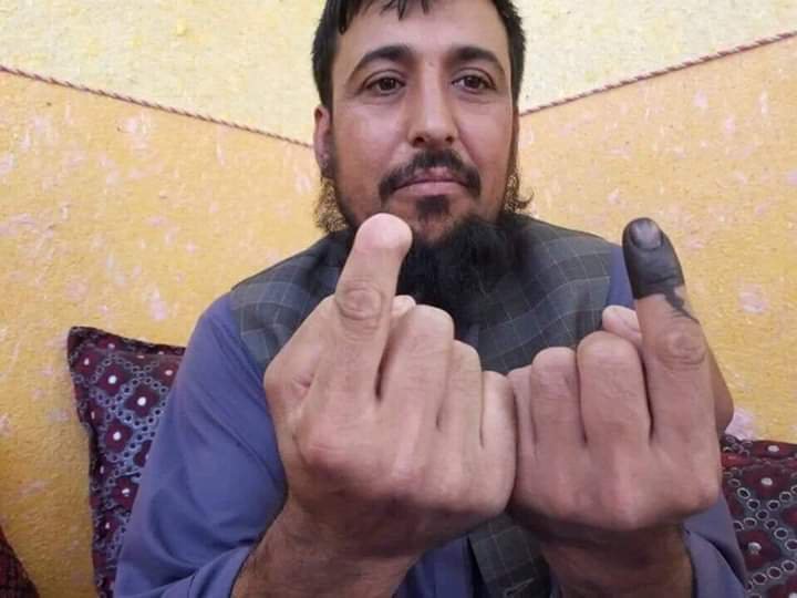 Safiullah Safi got his finger chopped by the Taliban for voting in 2014. He didn’t care about getting his other fingered chopped and voted.
